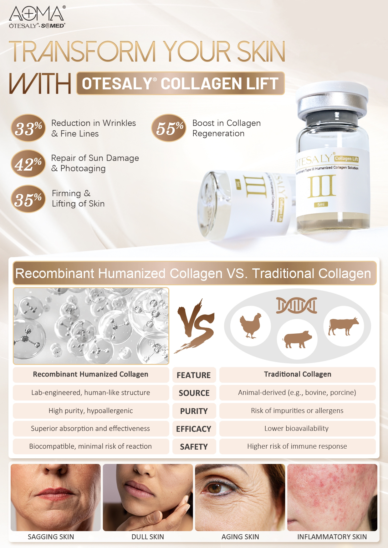 AOMA Collagen Lift AOMA 胶原蛋白提升术