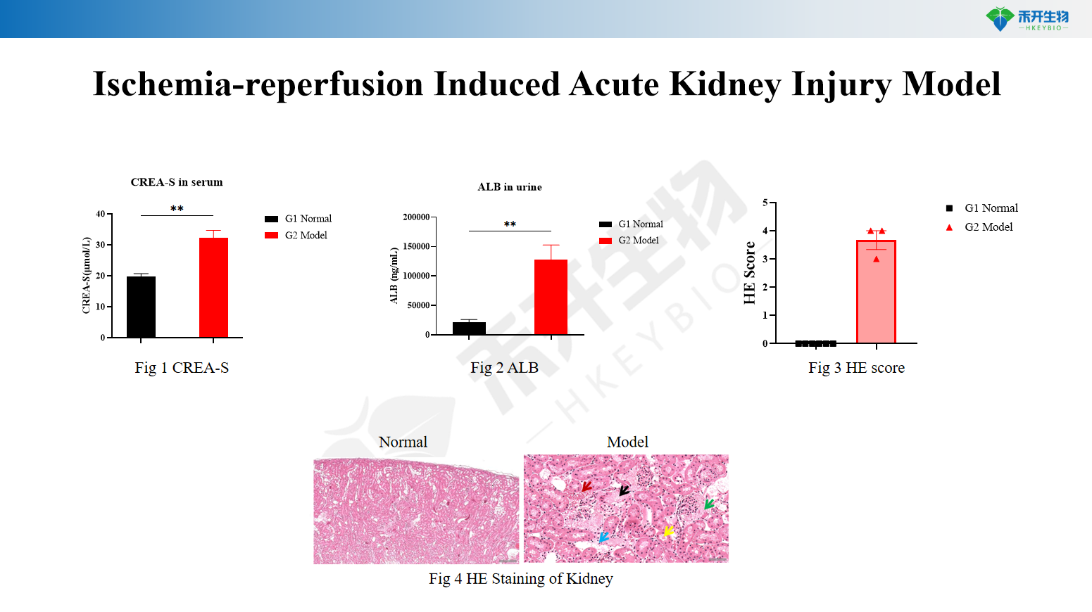 Ischemia-reperfusion Induced Acute Kidney Injury Model 4a79fce5c373b8f50f6e5126ca732e2f