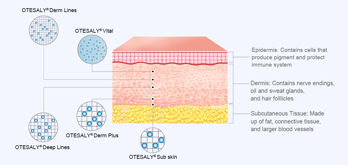 Dermal Filler Areas 真皮填充区域