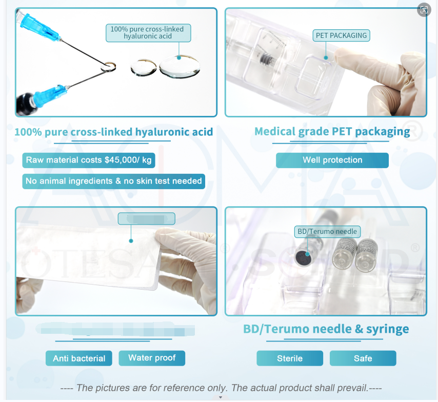 AOMA laboratory Dermal filler injection AOMA实验室真皮填充剂注射