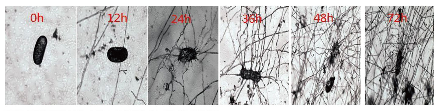Biocontrol Agent Of Root-Knot Nematode_03 Biokontrollmittel des Wurzelknotenfadenwurms_03