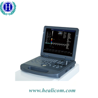 Escáner de ultrasonido Doppler color portátil 2D portátil de precio barato HUC-200