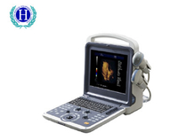 HUC-300 Tragbarer 4D-Farbdoppler-Ultraschall-Diagnosescanner für medizinische Geräte
