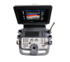 Medizinisches Diagnosesystem HUC-800 Voller digitaler Trolley-4D-Farbdoppler-Ultraschallscanner