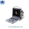 Escáner de diagnóstico por ultrasonido Doppler color portátil 4D de equipamiento médico HUC-300