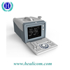 Escáner de ultrasonido barato portátil HBW-5Plus Ultrasonido de la máquina de ultrasonido