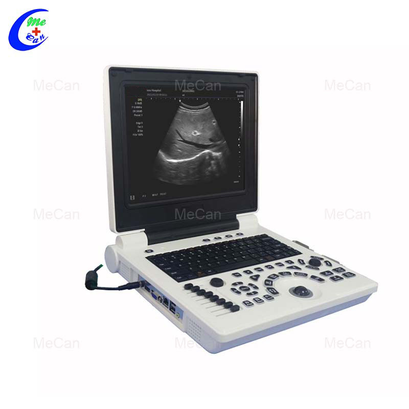 Warna Doppler Ultrasound - f&eacute;tal Imaging