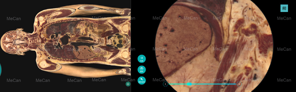3.Virtual Anatomy Table -Help ກັບຄໍາຮ້ອງສະຫມັກທາງດ້ານການຊ່ວຍແລະສະຫນອງເອກະສານອ້າງອີງສໍາລັບການສຶກສາ