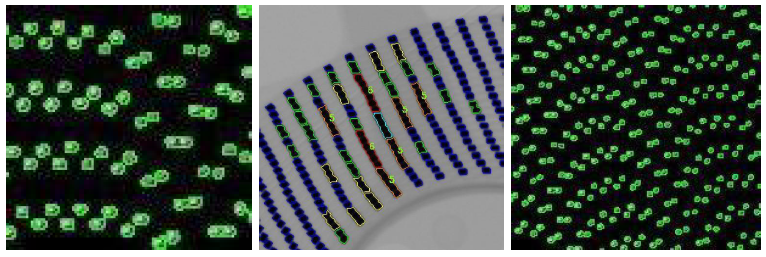 X-Ray Reel Component Counting Machine Check platform and AI algorithm