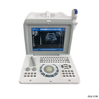 Medizinische Geräte HBW-2 tragbarer Ultraschall-Ultraschallscanner