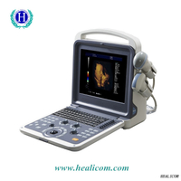 Escáner de diagnóstico por ultrasonido Doppler color portátil HUC-300
