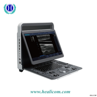 E1 Sonoscape Medical tragbares Ultraschall-Scanner-System Schwarz-Weiß-Ultraschallsonde-Maschinenpreis