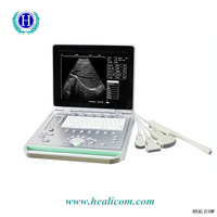 Hochwertiges tragbares 3D-Ultraschallgerät für medizinische Geräte HBW-7