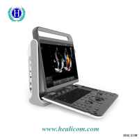 HUC-590-Diagnosesystem Tragbares digitales Ultraschallgerät 3D 4D-FarbdopplerHuc-590-Diagnosesystem Tragbares digitales Ultraschallgerät 3D 4D-Farbdoppler