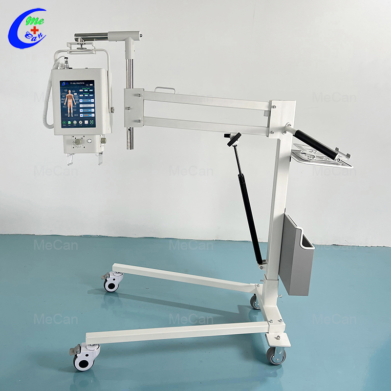 Portable Digital X Ray Machine-2