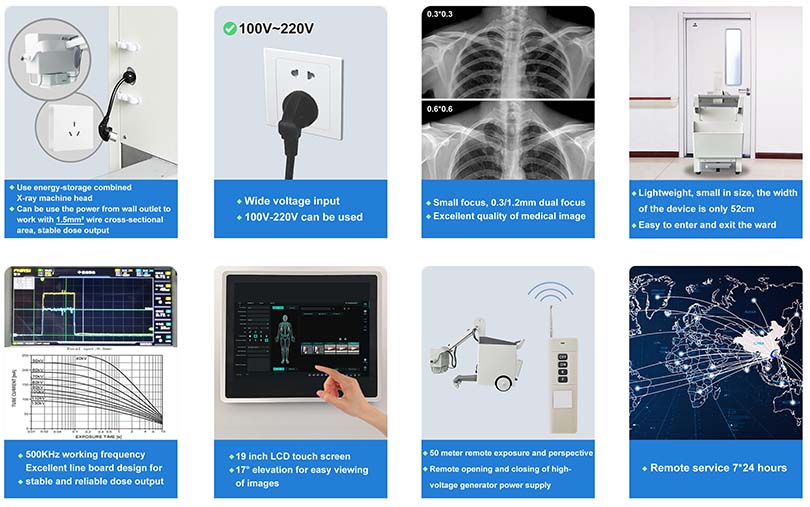 32KW Digital Mobile X-ray Machine caratteristiche
