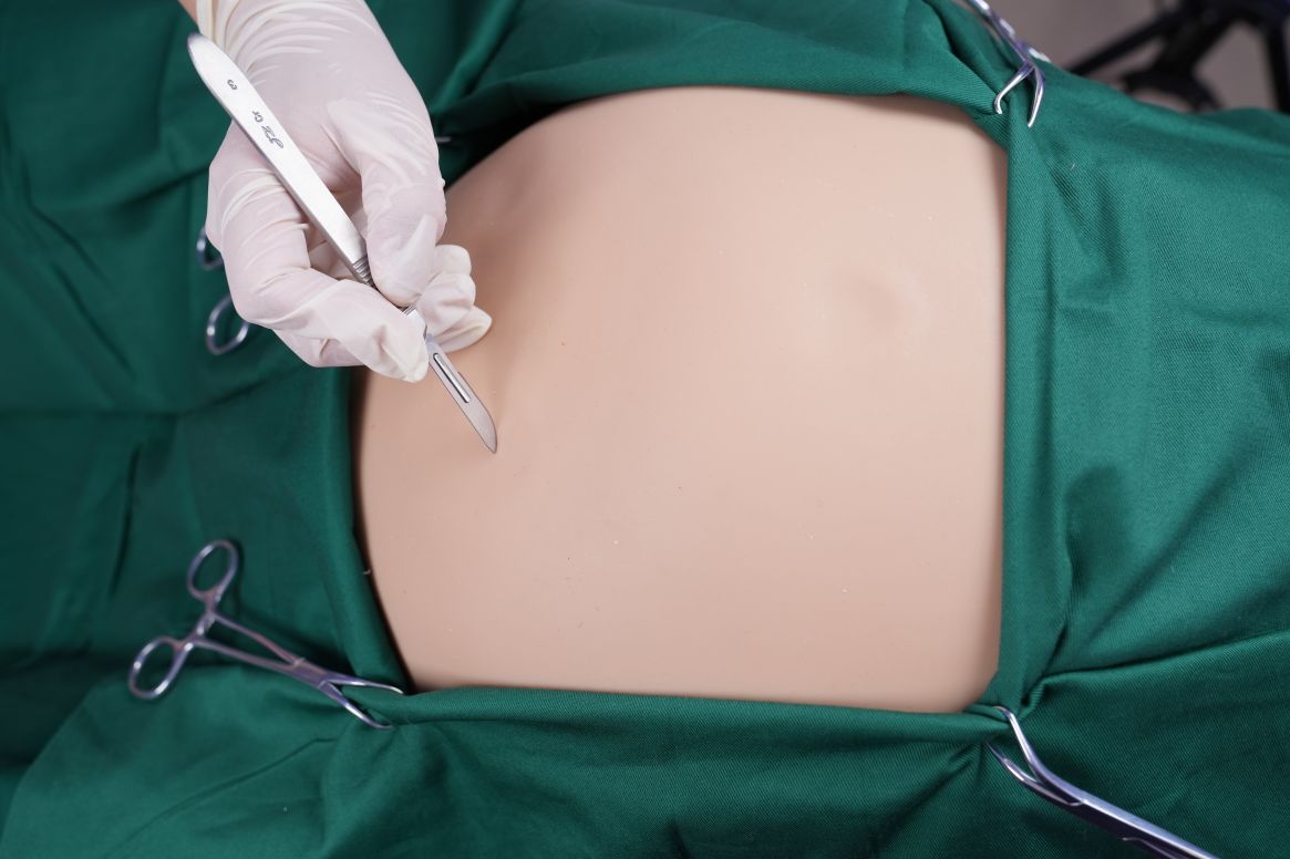 모듈식 제왕절개 시뮬레이터