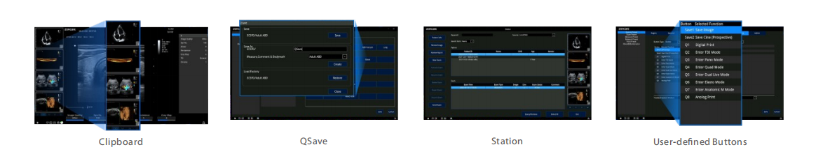 Workflow mahomby sy haingana