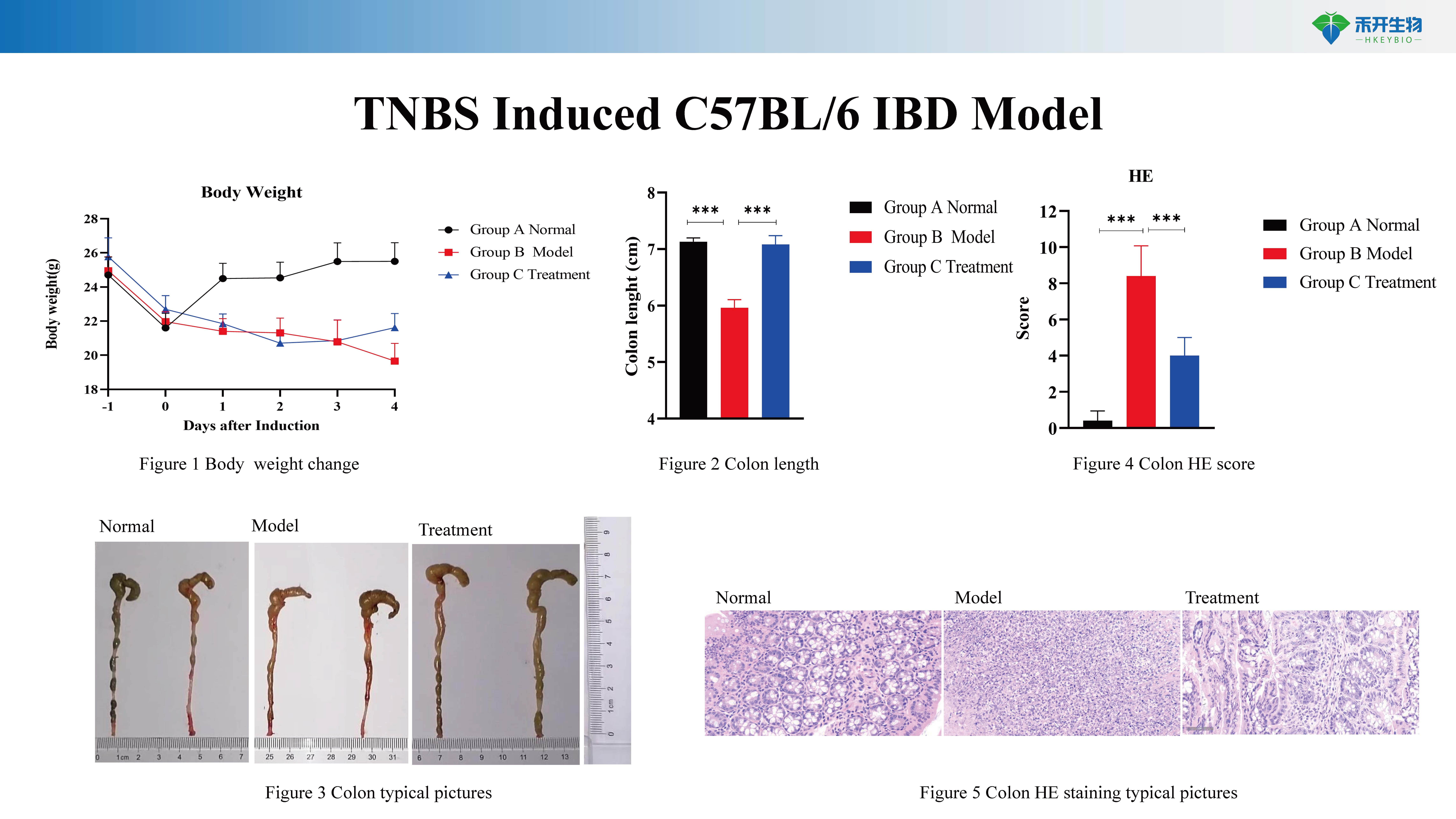 炎症性肠炎 IBD模型介绍 2024026_20240603150729_页面_3