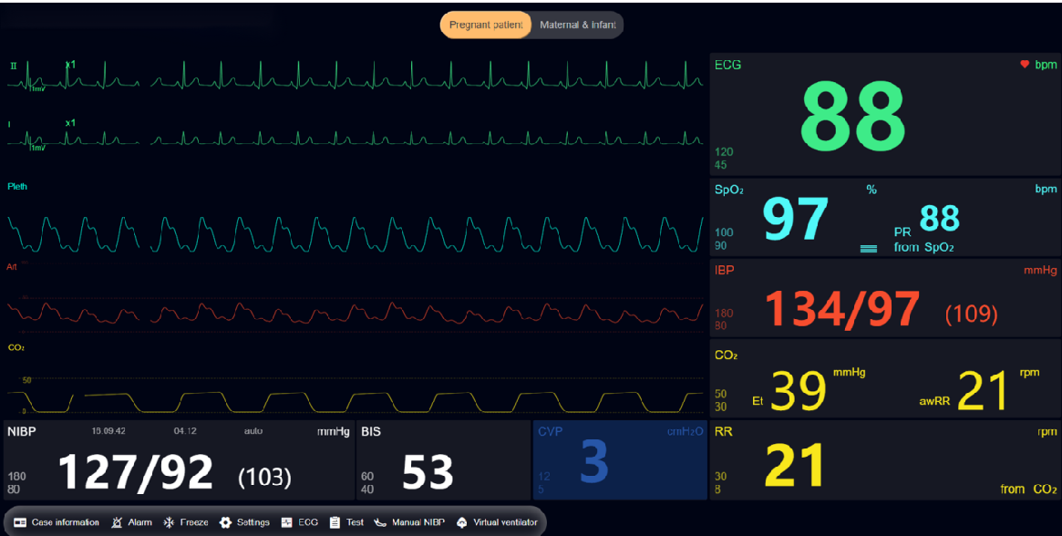 MECANMED MCE0937 پيدائش سميوليٽر حقيقي وقت زچگي جي اهم نشاني مانيٽرنگ ڏيکاريندي
