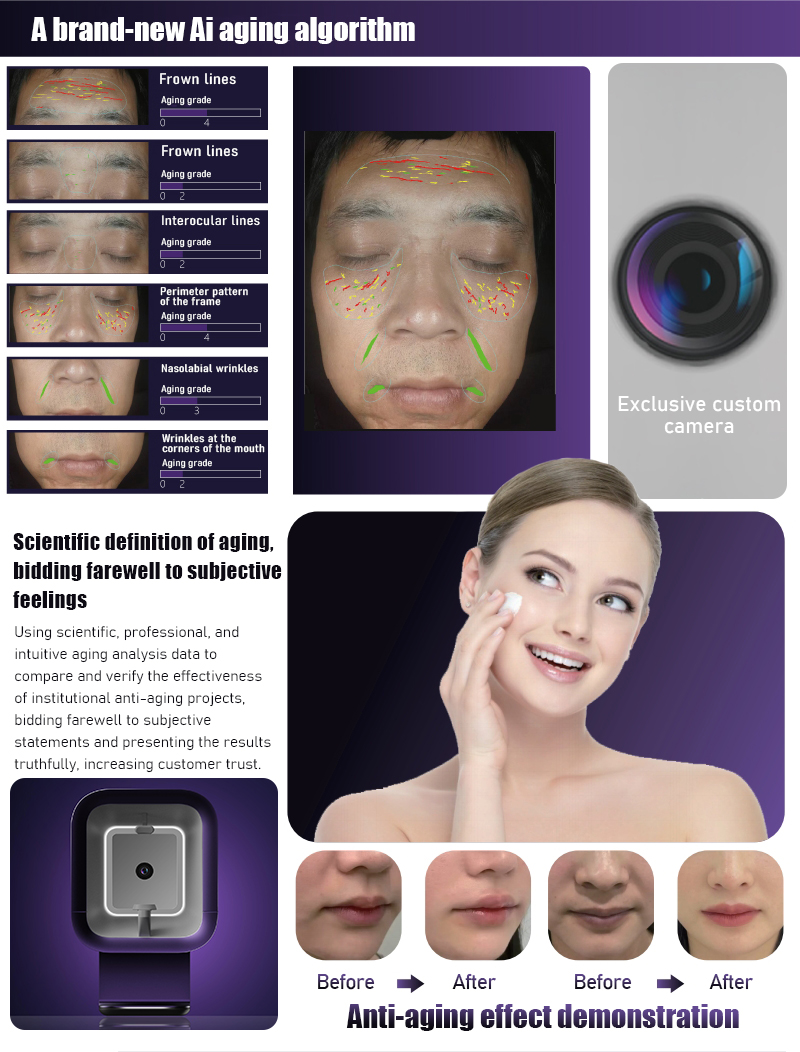 Analizador de piel, m&aacute;quina analizadora de piel, m&aacute;quina analizadora de piel facial, analizador de piel 3d, analizador de piel AI, analizador de piel facial, analizador de piel m&oacute;vil, analizador de piel con l&aacute;mpara de madera, analizador de piel con esc&aacute;ner facial, analizador de piel con esc&aacute;ner facial