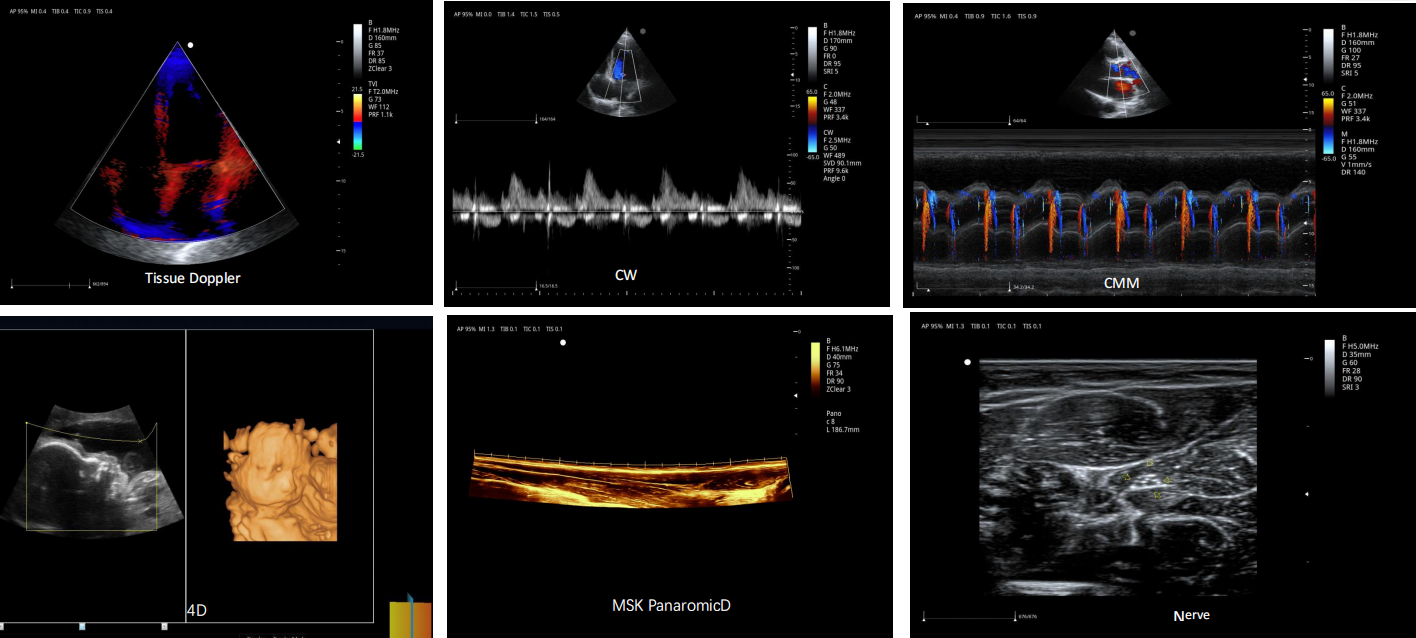 Faarf Doppler Ultraschall Maschinn