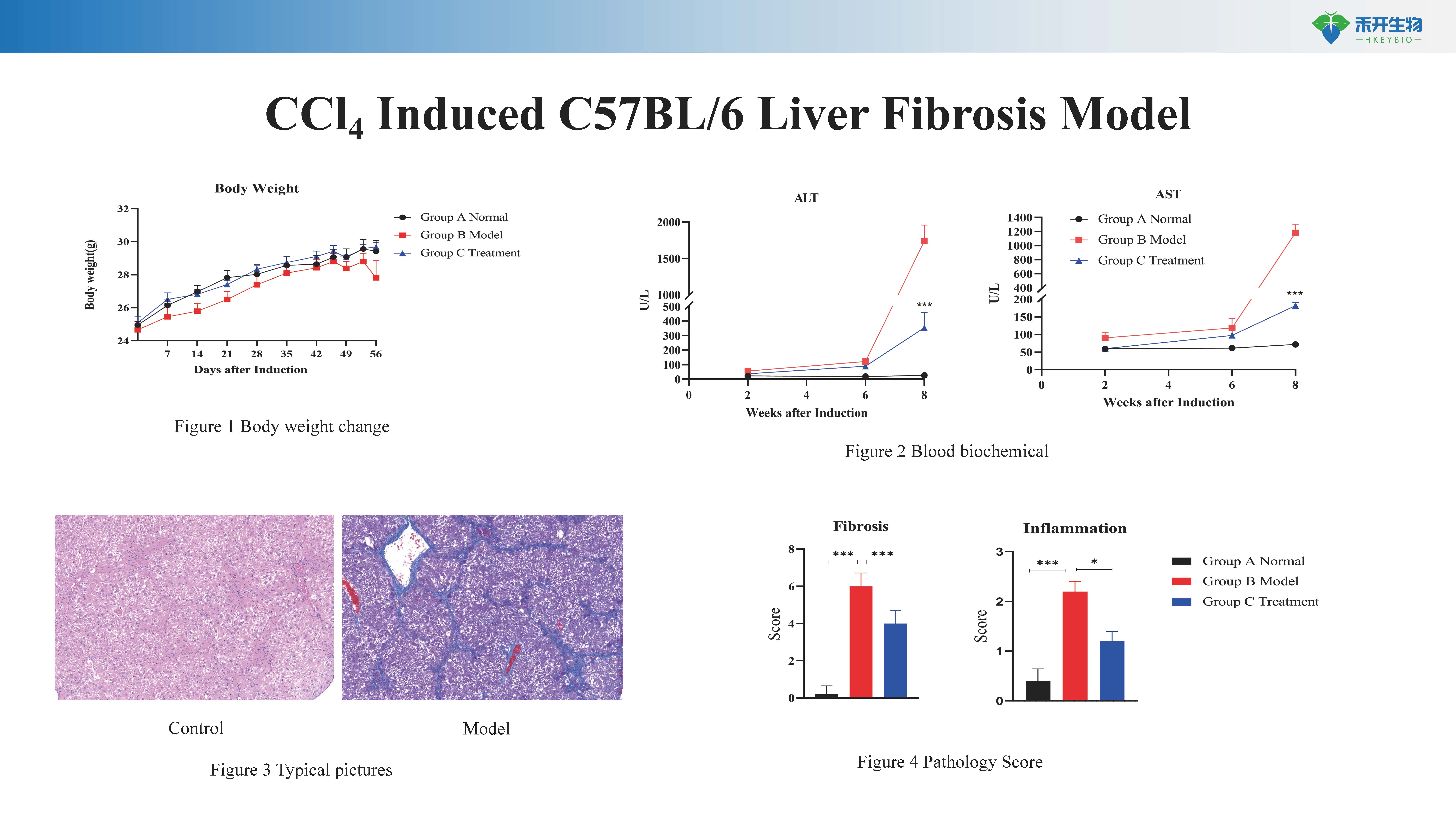 肝脏纤维化模型介绍-C57BL6 20231102_20240614110623