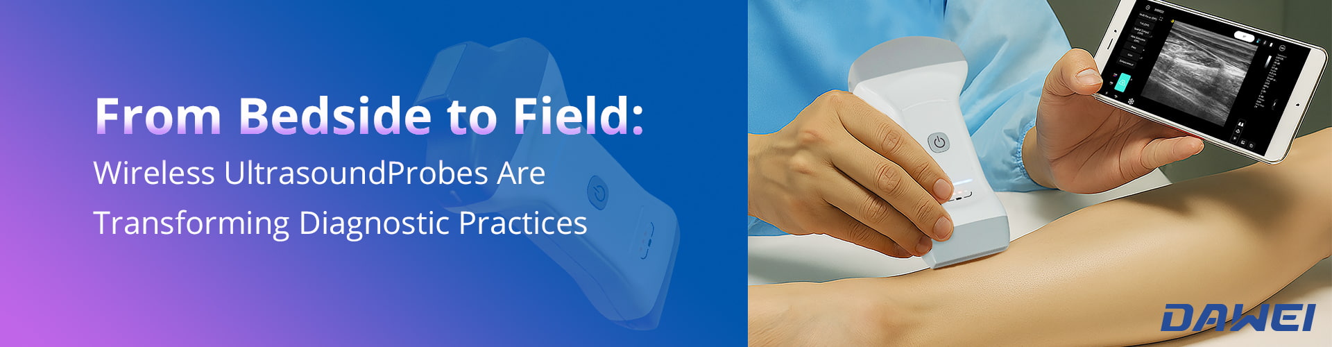 Төсек басынан далаға сымсыз ультрадыбыстық зондтар диагностикалық тәжірибені қалай өзгертеді