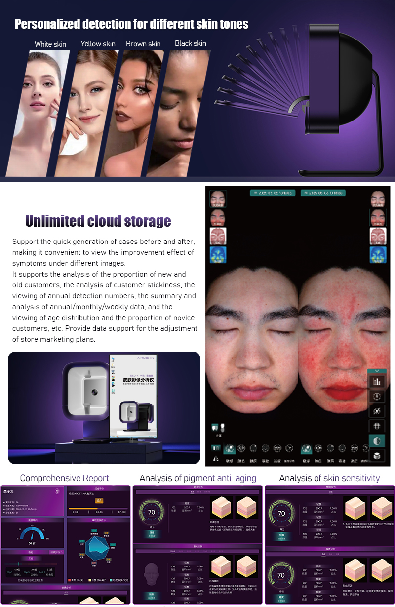 Analizador de piel, m&aacute;quina analizadora de piel, m&aacute;quina analizadora de piel facial, analizador de piel 3d, analizador de piel AI, analizador de piel facial, analizador de piel m&oacute;vil, analizador de piel con l&aacute;mpara de madera, analizador de piel con esc&aacute;ner facial, analizador de piel con esc&aacute;ner facial