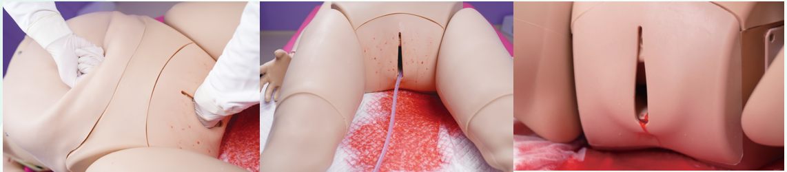 MECANMED MCE0937 ترتيب ڏيڻ واري بليڊنگ سسٽم سان پوسٽ پارٽم هيمريج کي ترتيب ڏيڻ