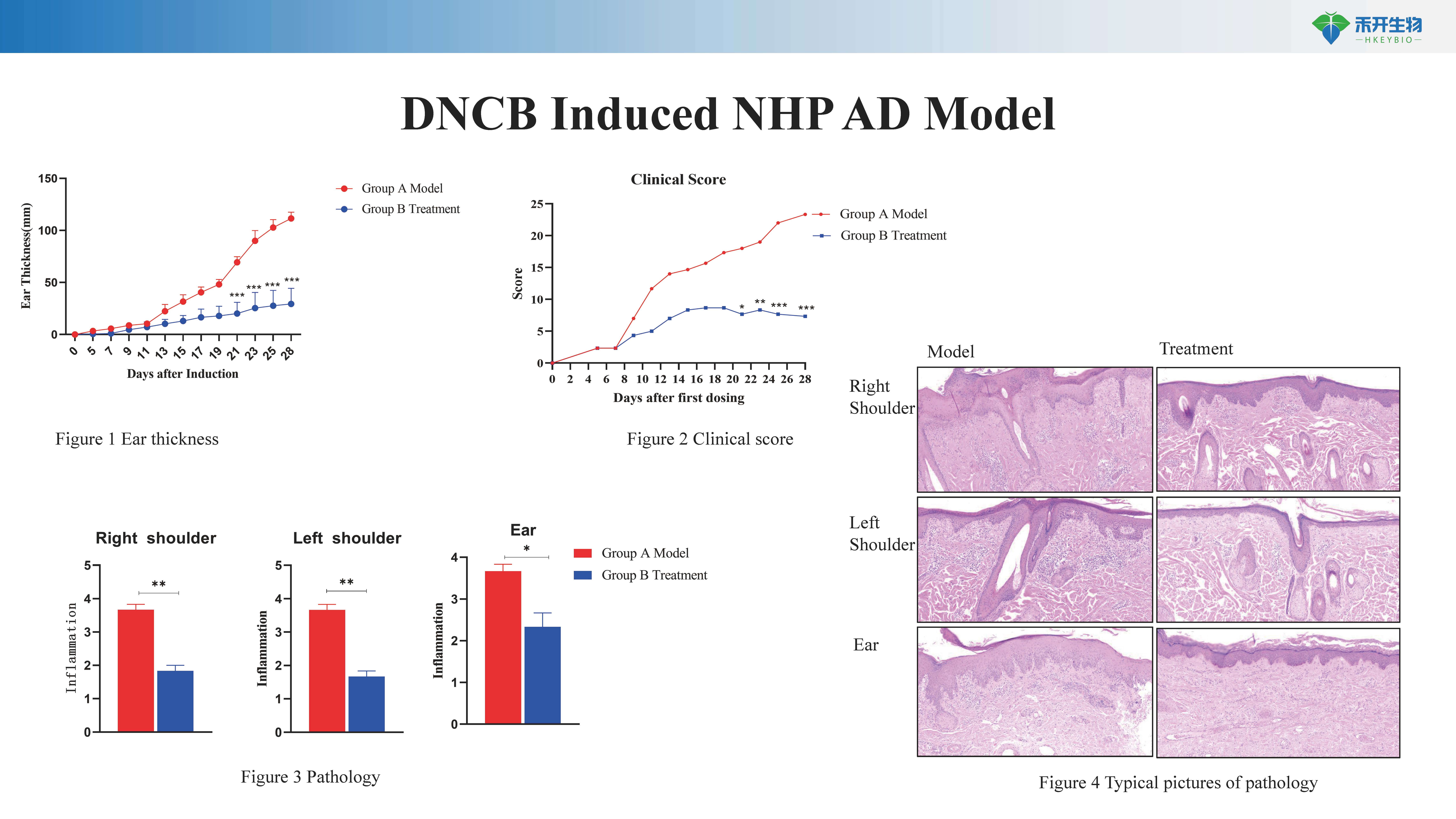 NHP 特应性皮炎 AD模型介绍-20230629-BW_20240613091419