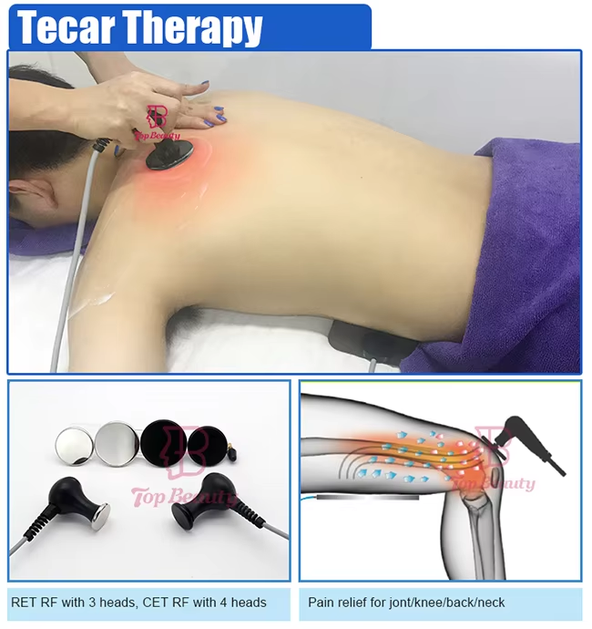 Sto&szlig;wellentherapie (2).png