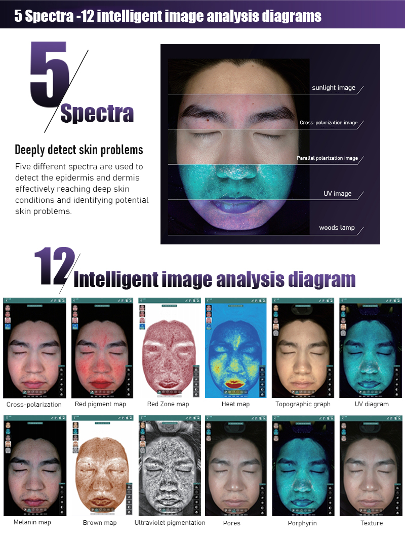 5 espectros Detecci&oacute;n de alta precisi&oacute;n &iexcl;Diagramas de an&aacute;lisis inteligentes para 12 tipos de proyectos!