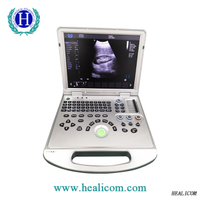 HUC-250 2D / 3D Laptop / Escáner de ultrasonido Doppler color portátil