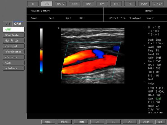 (MS-C6500) Escáner de ultrasonido Doppler a color con carro hospitalario