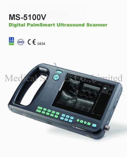 (MS-5100V) Scanner vétérinaire portable de scanner vétérinaire d'ultrason  d'ordinateur portable médical