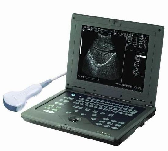 (MS-5000) Unidad de escáner portátil portátil Escáner de ultrasonido portátil digital